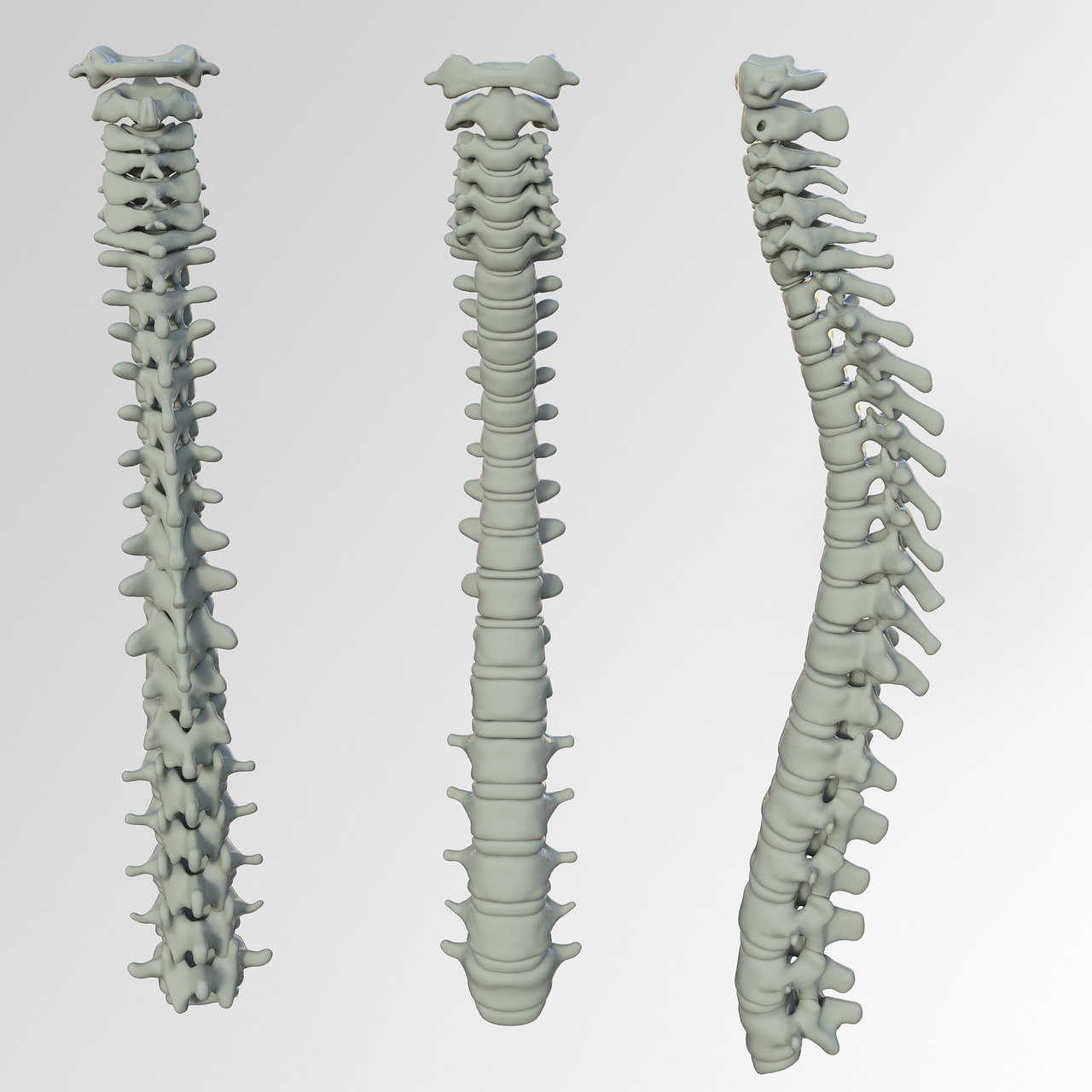 Spinal Screenings Fremont, CA